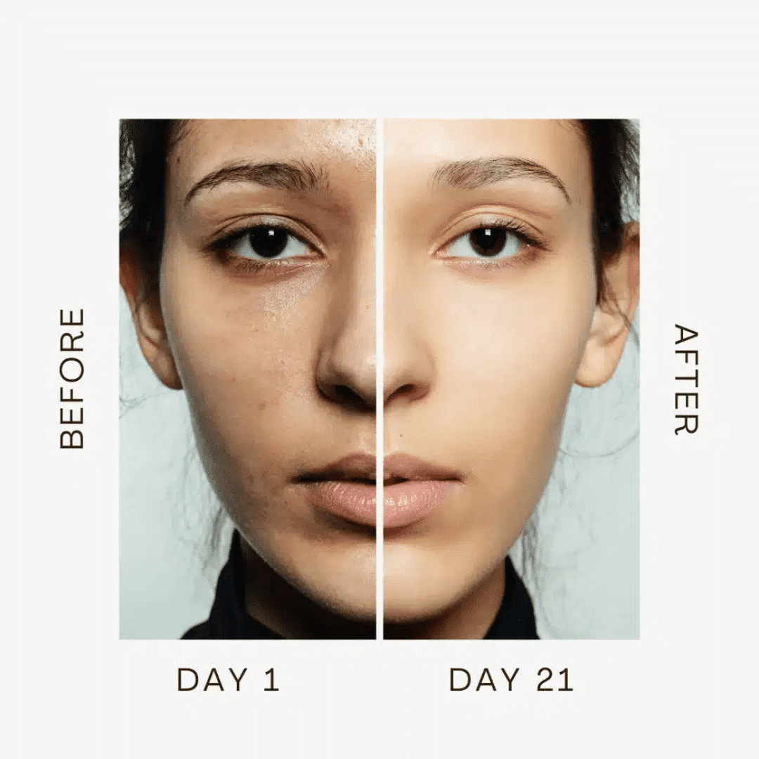 RenewaLift Device (Official Retailer) 2025