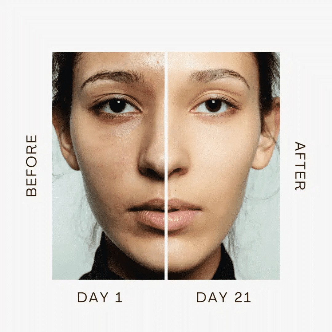 True Beauty Glow Before and After