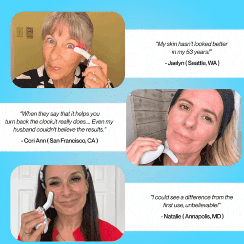 Aurora Skin Facial Sculptor (Official Retailer) 2026