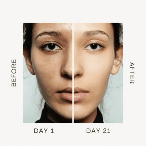 Aurora Skin Facial Sculptor (Official Retailer) 2026