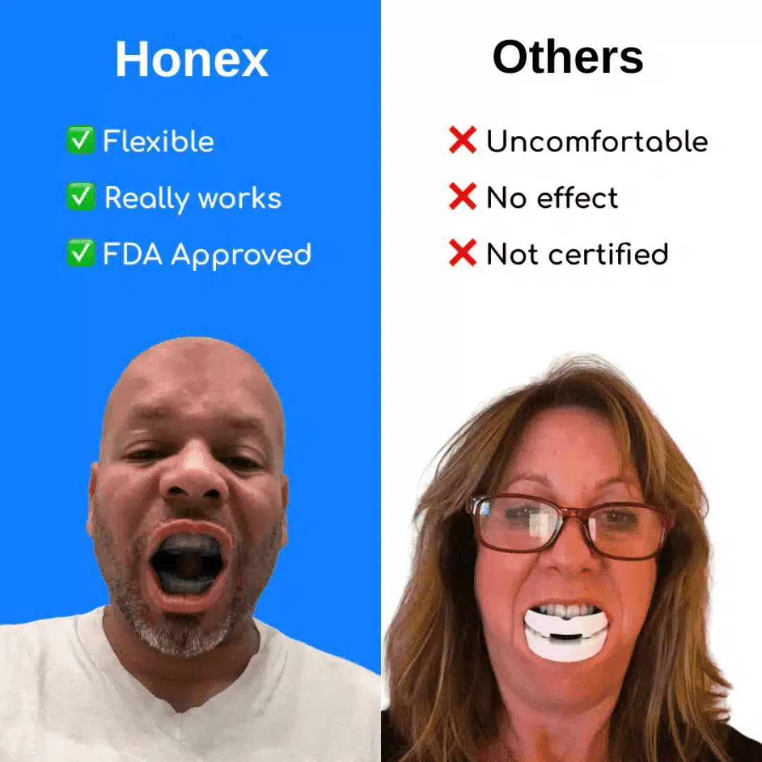 Honex Anti-Snoring Mouthpiece (Official Retailer) 2025