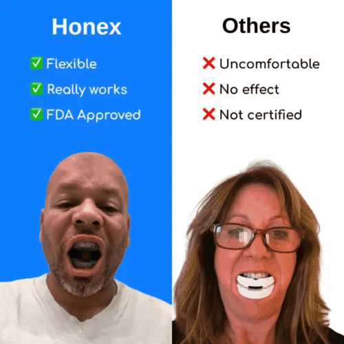 Honex Anti-Snoring Mouthpiece - Official Retailer