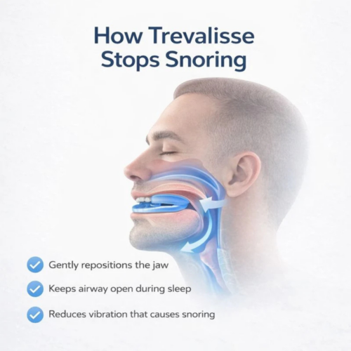 Trevalisse Anti-Snoring Mouthpiece - Official Retailer