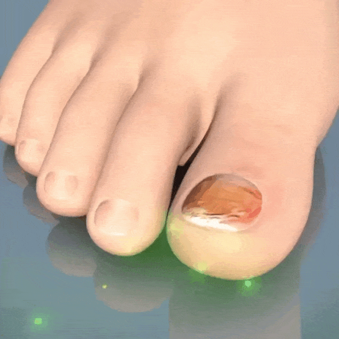 FungaBeam (Official Retailer) 2025