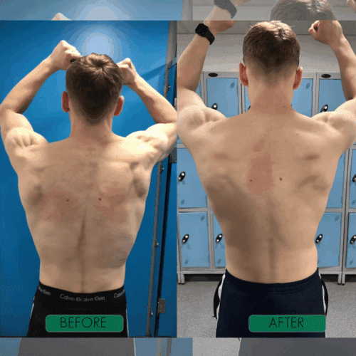 CoreCare Posture Corrector - Official Retailer