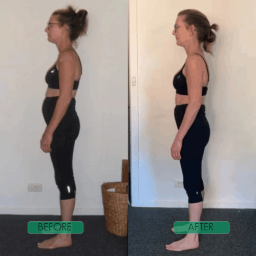 CoreCare Posture Corrector - Official Retailer