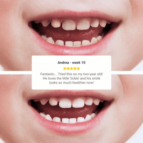 WellaWhite Electric Toothbrush (Official Retailer) [year]