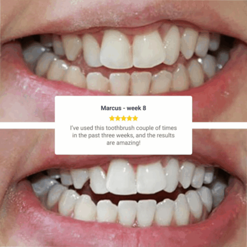 WellaWhite Electric Toothbrush (Official Retailer) [year]