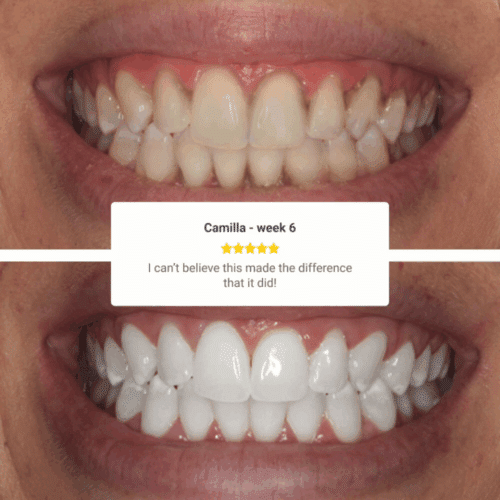 WellaWhite Electric Toothbrush (Official Retailer) [year]